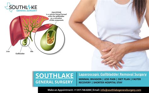 Worsening pain in your belly. . Female gallbladder surgery recovery time laparoscopic